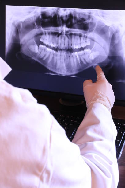 Best Emergency Dental Care for Sports Injuries in Mapleton, ND